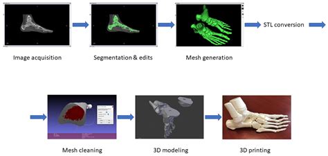 CT Conversion Workflow for Intraoperative Usage of Bony Models: From ...