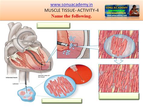 SONU ACADEMY: MUSCLE TISSUE-ACTIVITY(4)