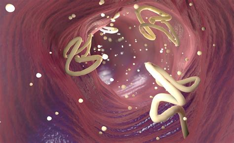 डॉक्टर ने बताया आंतों में कीड़े होने पर किस खनिज की हो जाती है कमी ...