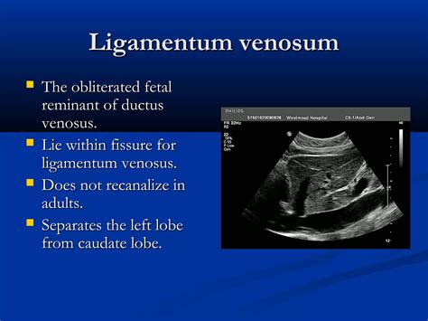 Liver ultrasound | PPT