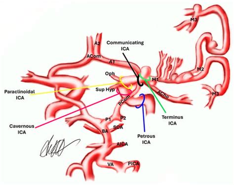 Geometry and Symmetry of Willis’ Circle and Middle Cerebral Artery ...