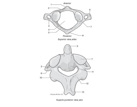 Labeling Axis and Atlas Vertebrae Quiz