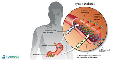 Duphalac Lemon Flavour Oral Solution: Uses, Side Effects, Price ...