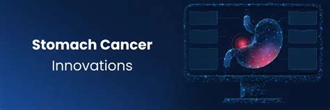 Innovaciones en el tratamiento del cáncer de estómago en los hospitales ...