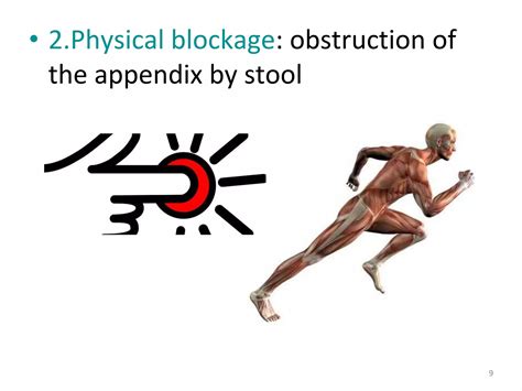 Image result for Appendicitis Position