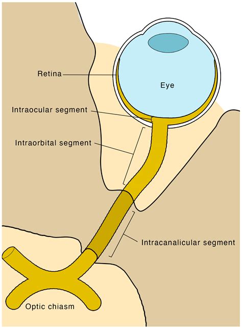 A Narrative Review of Point of Care Ultrasound Assessment of the Optic ...