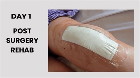 Image result for Total Knee Replacement Exercise Program