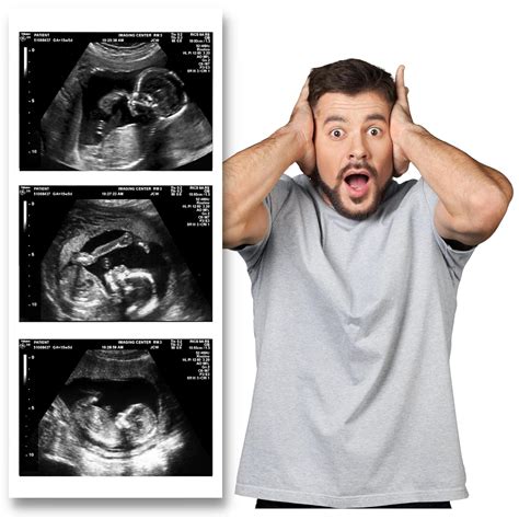 Buy Fake Ultrasound Prank Pictures | 2D Strip of 3 Photos | Pregnancy ...