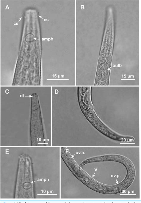 Figure 2 from Three new species of free-living marine nematodes of the Microlaimus genus ...