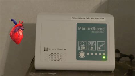 Image result for Merlin Pacemaker Monitor