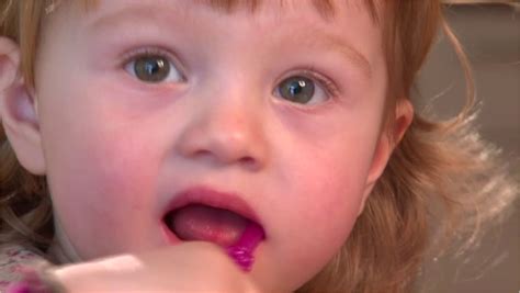 Mandibular advancements splints (MAS) in the treatment of the ...