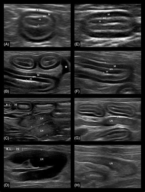 Clinical, laboratory and ultrasonographic findings differentiating low ...