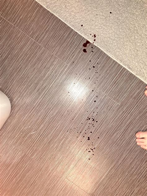 Image result for Abscess Explosion