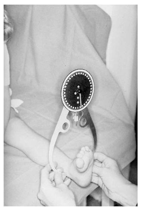 Measurement of Tibial Torsion