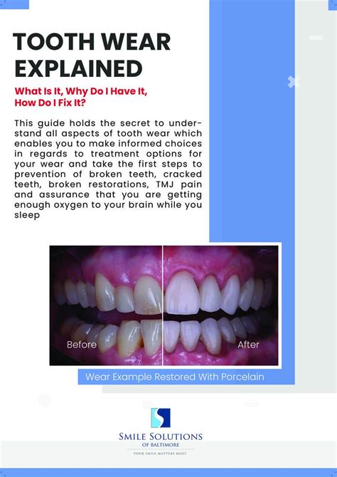 Entry #119 by Emangamalgomaa for Tooth Wear Explained: What Is It, Why ...