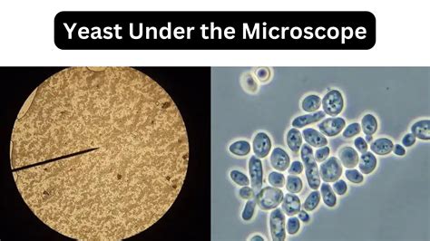 Bacteria Reproducing Under a Microscope 的图像结果