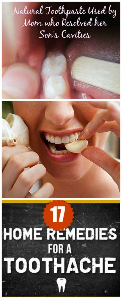 Ayurvedic Treatment For Tooth Nerve Pain at Jamie Mealmaker blog