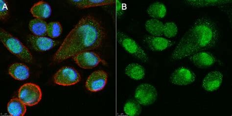 Anti-Ku70 Antibody, clone N3H10 | MABE1879-25UG