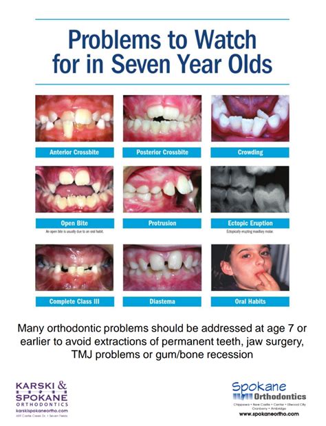 Orthodontic Teeth Problems at Phillip Dorsey blog