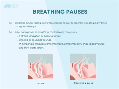 Image result for Sleep Apnea Example