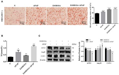 Caveolin-1 Alleviates Acetaminophen—Induced Hepatotoxicity in Alcoholic ...