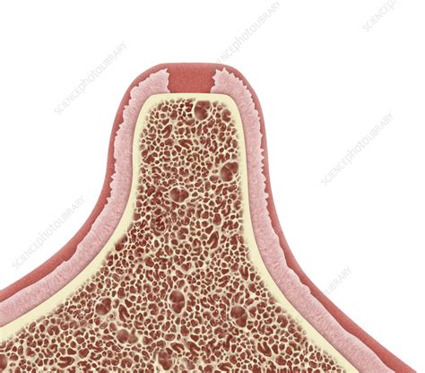 Image result for Healed Tooth Extraction