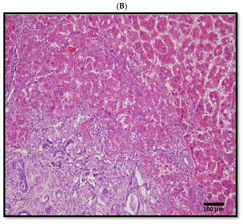 A Multi-Gene Signature Associated with 1-Year Survival in Patients with ...