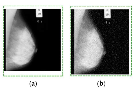 Breast Cancer Detection Using Mammogram Images with Improved Multi ...
