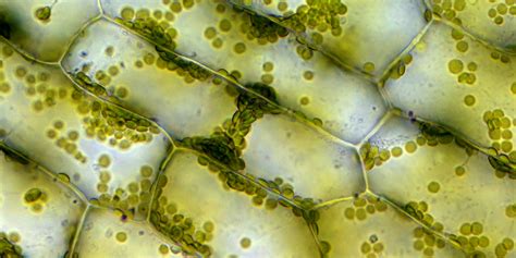 What Does Elodea Look Like Under A Microscope - Infoupdate.org