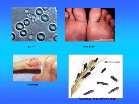 Pathogen 的图像结果