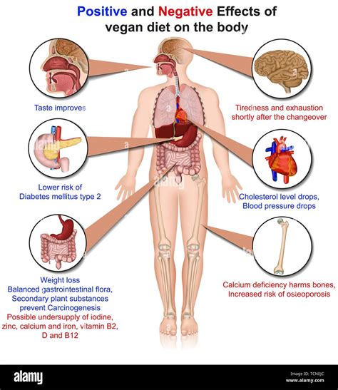 Positive and negative effects of vegan diet, 3d medical vector illustration Stock Vector Image ...