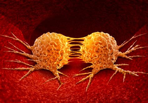 Image result for Cancer Detection Using Graph CNN
