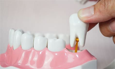 Teeth Extraction With Bone Graft | Dental Bone Graft
