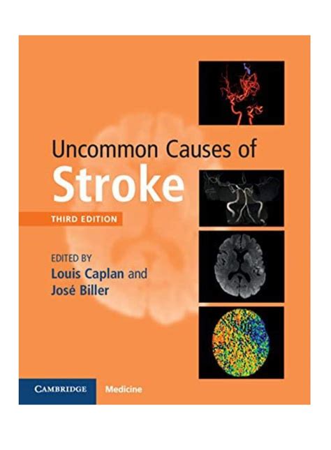 Buy Uncommon Causes of Stroke 3ED Book Online at Low Prices in India ...