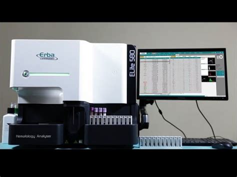 ELite 580 :: Transasia Bio-Medicals