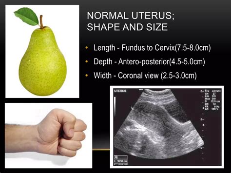 Basic gynae ultrasound | PPTX