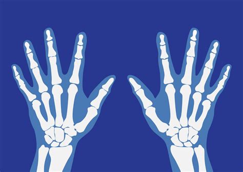 What is Rheumatology? - Rheumatology Physio