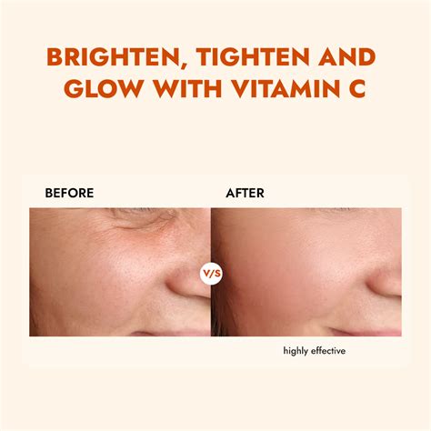 Best Vitamin C Face Serum for Glowing & brightening Skin – ALZIBA CARES