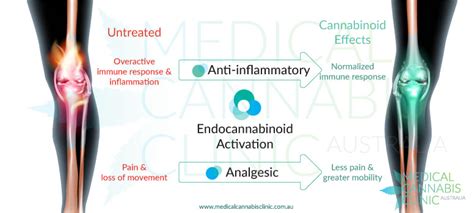 Rheumatoid Arthritis Community: Support, Resources, and Discussion