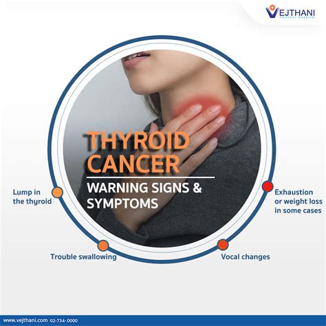 Thyroid Cancer is Treatable! - Life Cancer Center