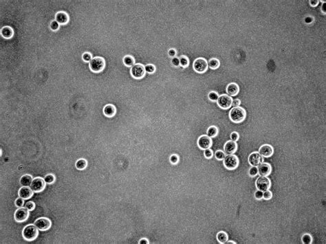Yeast Cells Under Microscope 40x