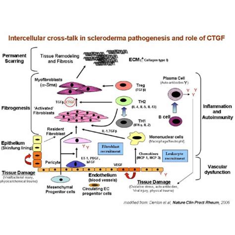 Image result for Diffuse Systemic Scleroderma