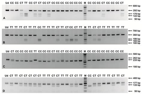 Single Nucleotide Polymorphisms from CSF2, FLT1, TFPI and TLR9 Genes ...