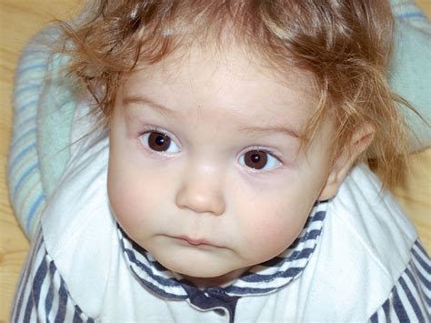 Is it normal for my toddler to have body hair? | BabyCenter