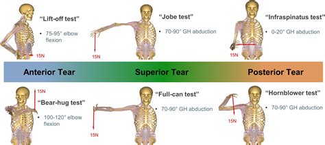 Biomechanical evaluation of physical examination tests for rotator cuff ...