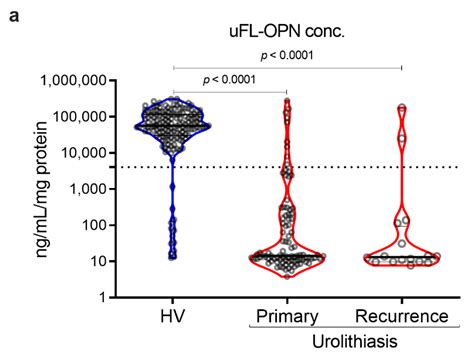 The Impact of Glycosylation of Osteopontin on Urinary Stone Formation