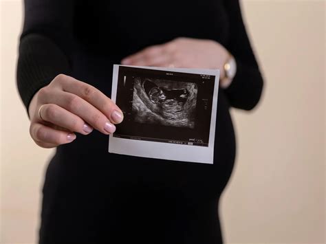 8 Weeks Ultrasound Scan: Essential Guide What to Expect