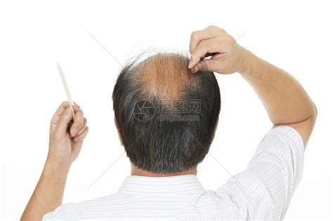 中年秃头秃顶男人梳头高清图片下载-正版图片501661373-摄图网