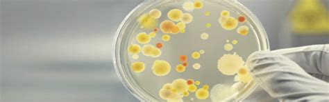 Anionic Polyelectrolyte