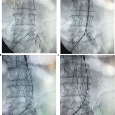 Image result for Contralateral Side